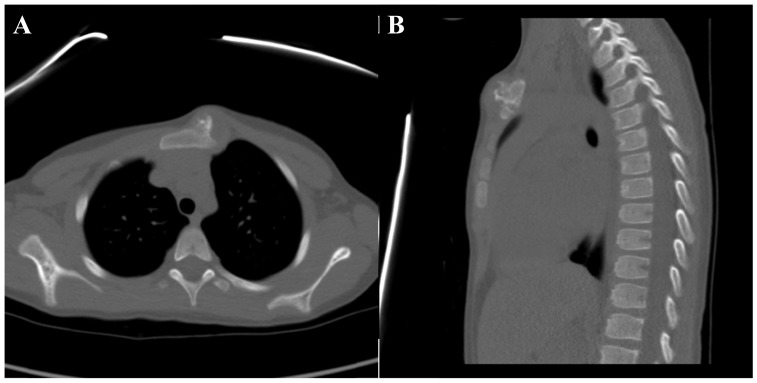 Fig. (2)