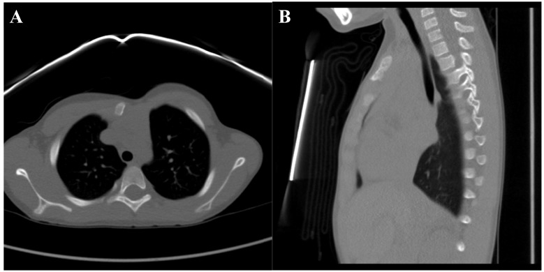 Fig. (7)