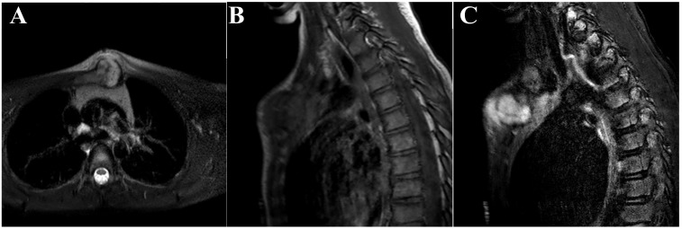 Fig. (3)