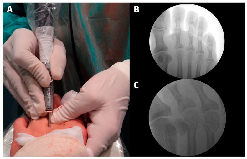 Figure 2