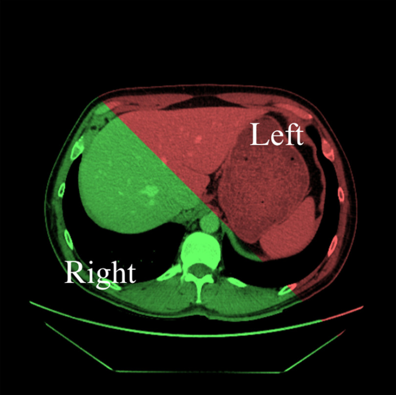 Fig. 1