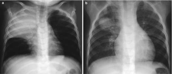 Fig. 13.7