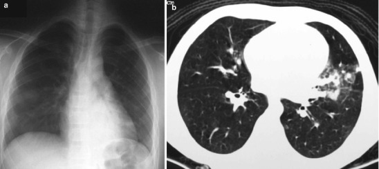 Fig. 13.3
