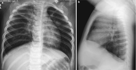 Fig. 13.1