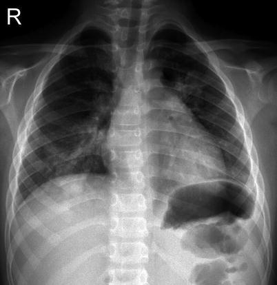 Fig. 13.4