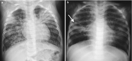 Fig. 13.30