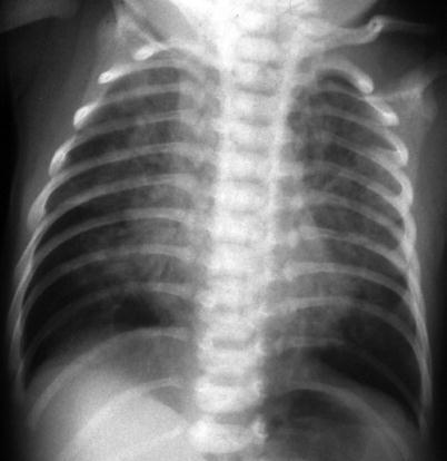 Fig. 13.16