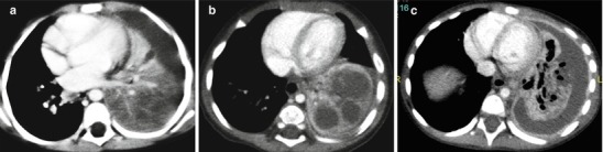 Fig. 13.10