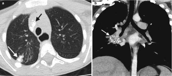 Fig. 13.25