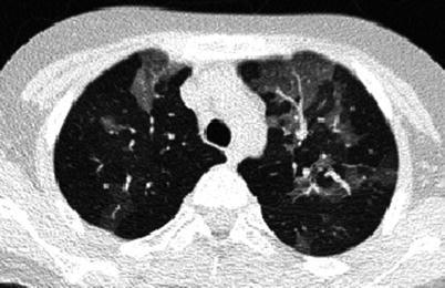 Fig. 13.5