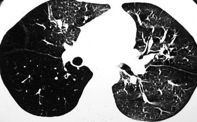 Fig. 13.6