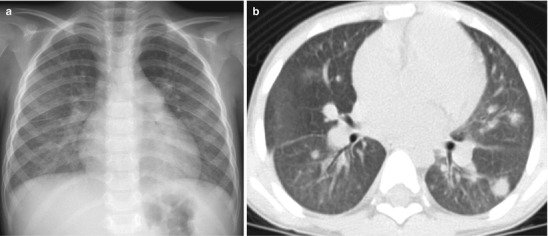 Fig. 13.24