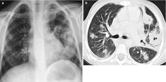Fig. 13.28