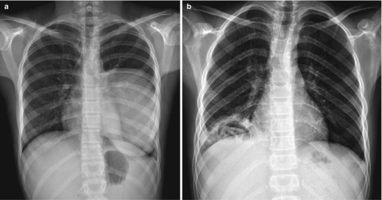 Fig. 13.26