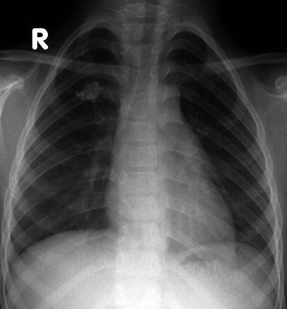 Fig. 13.17
