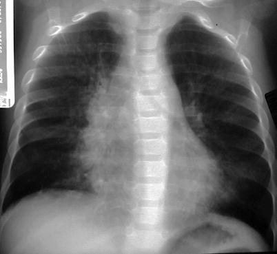 Fig. 13.14