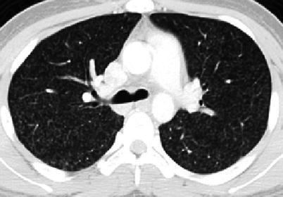 Fig. 13.21
