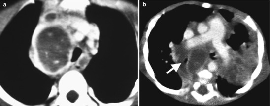 Fig. 13.20