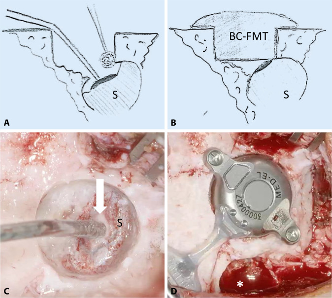 Fig. 9