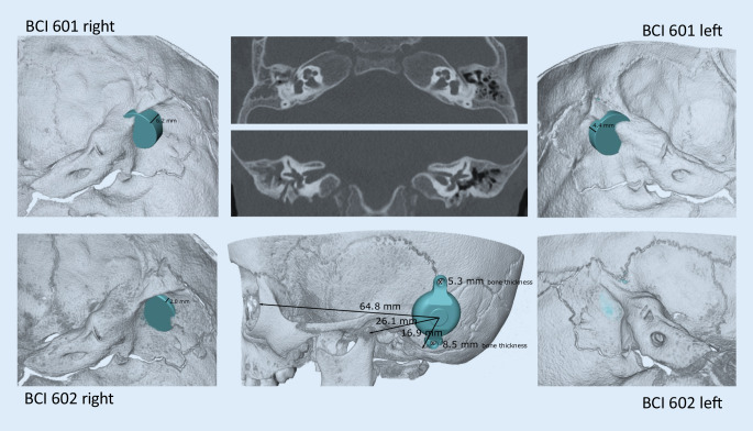 Fig. 10
