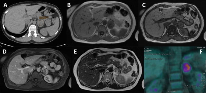 Fig. 2