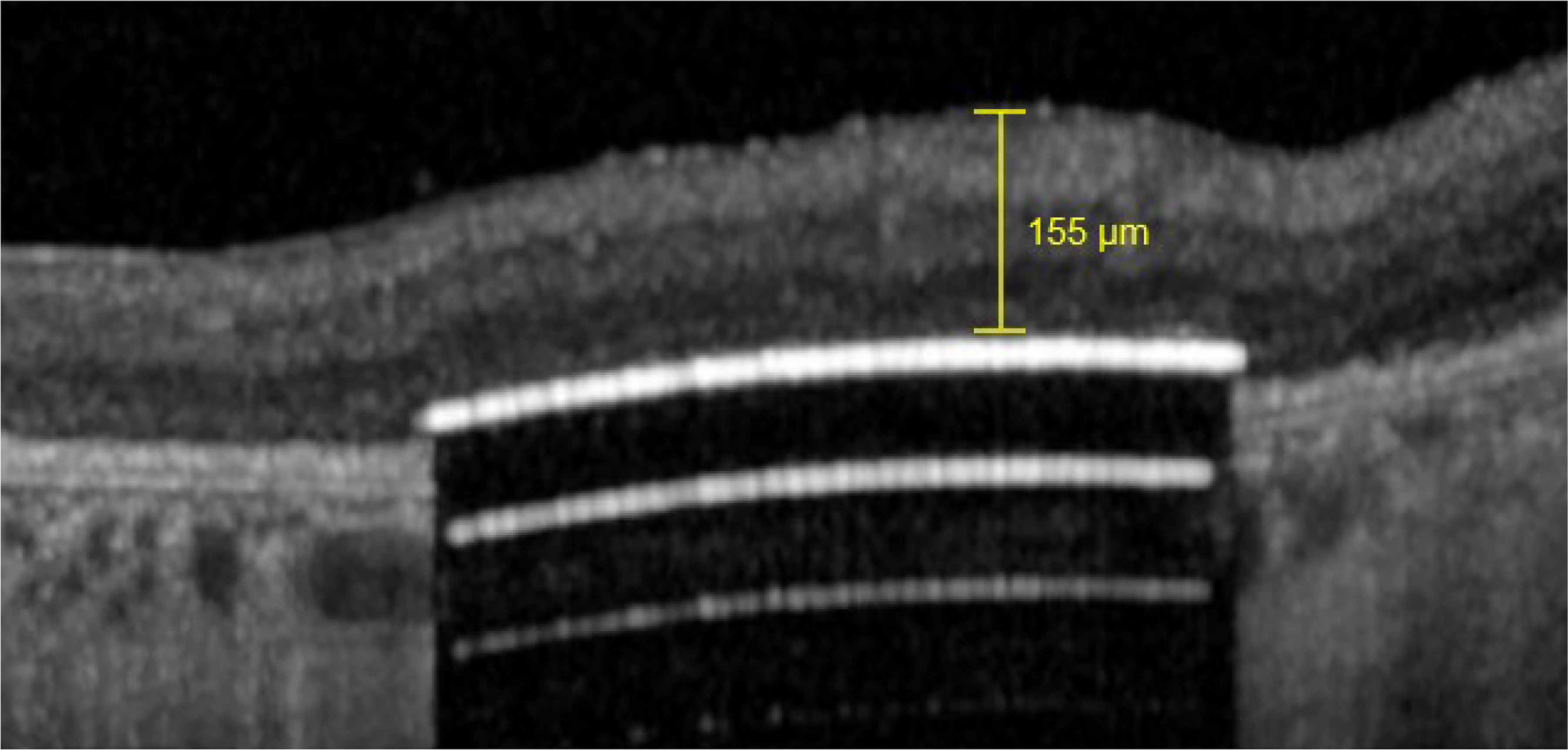 Figure 5A: