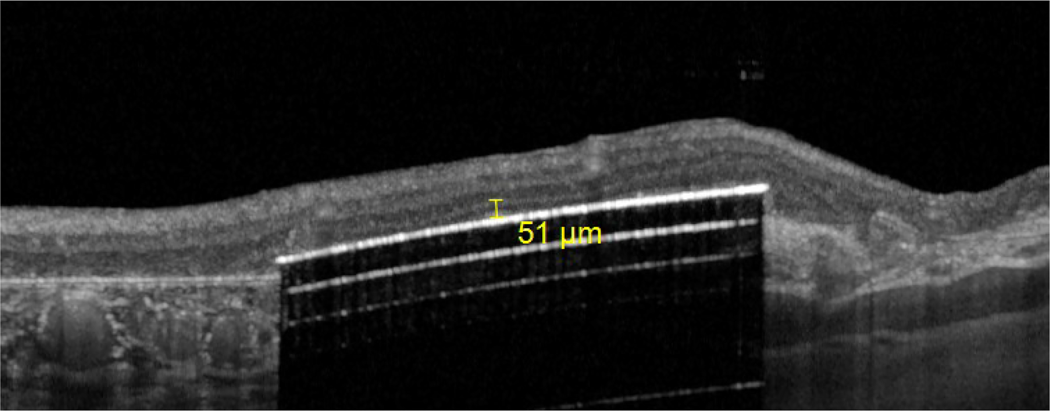 Figure 5B: