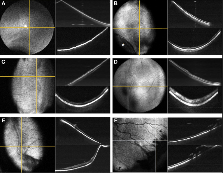 Figure 1