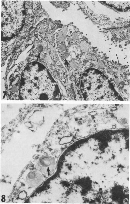 Figure 7 and 8