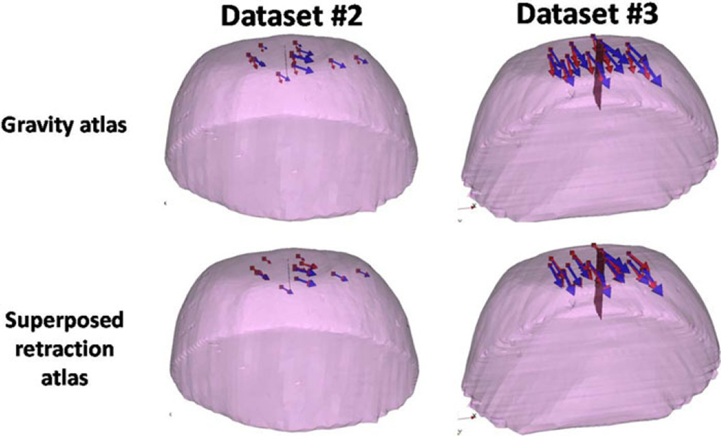 Fig. 11