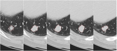 Fig 3