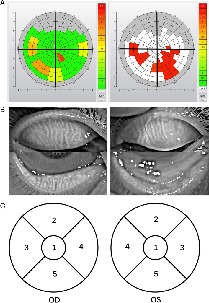 Fig. 1