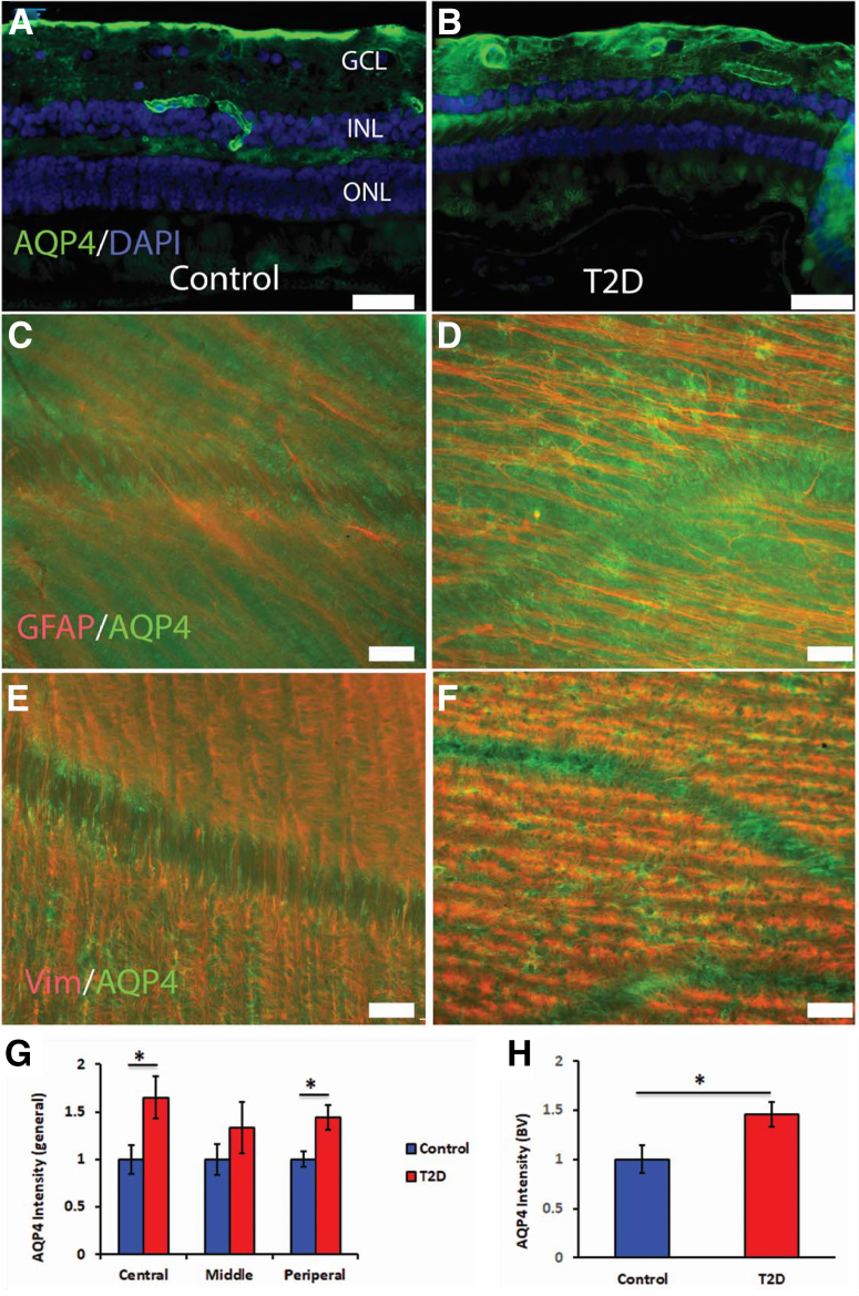 Figure 15