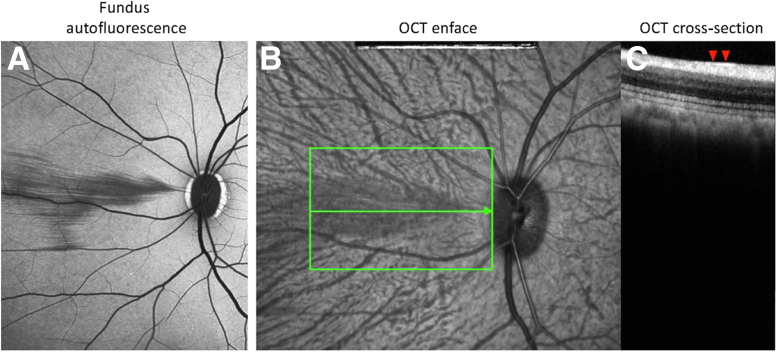 Figure 4