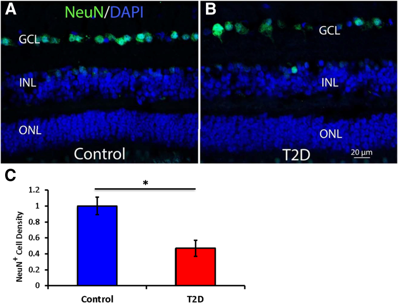 Figure 12