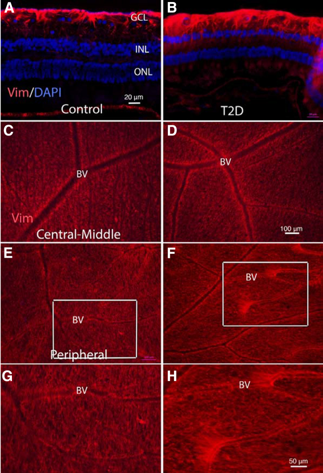 Figure 11