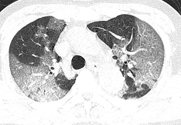 Figure 3c: