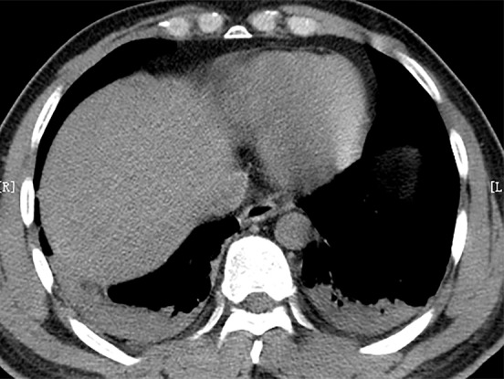 Figure 1c: