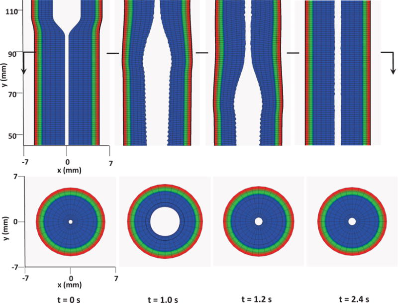 Fig. 11