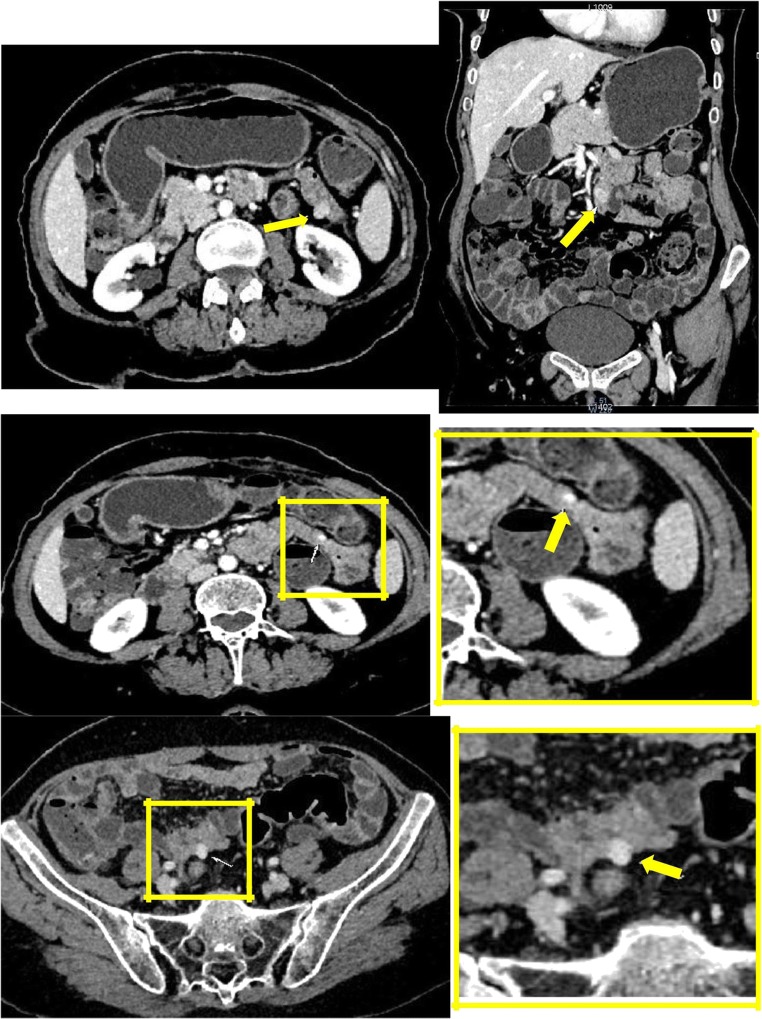 Fig. 2