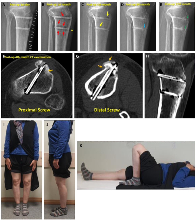 Figure 3.