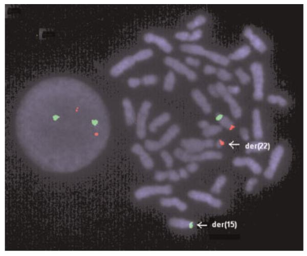 Fig. 2