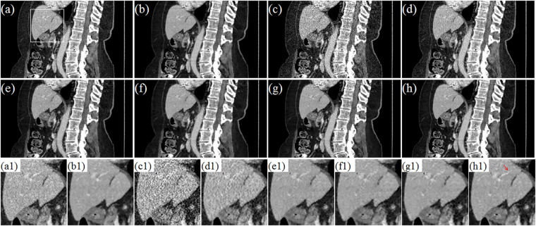 Figure 12