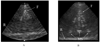 Fig. 13