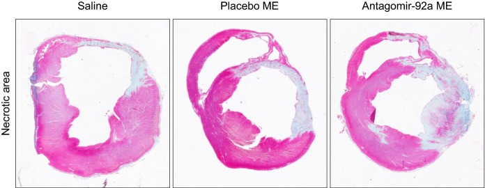 Figure 14.