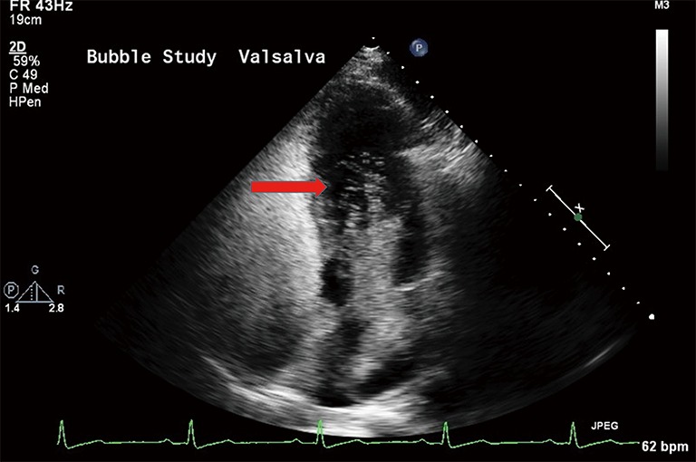 Figure 9