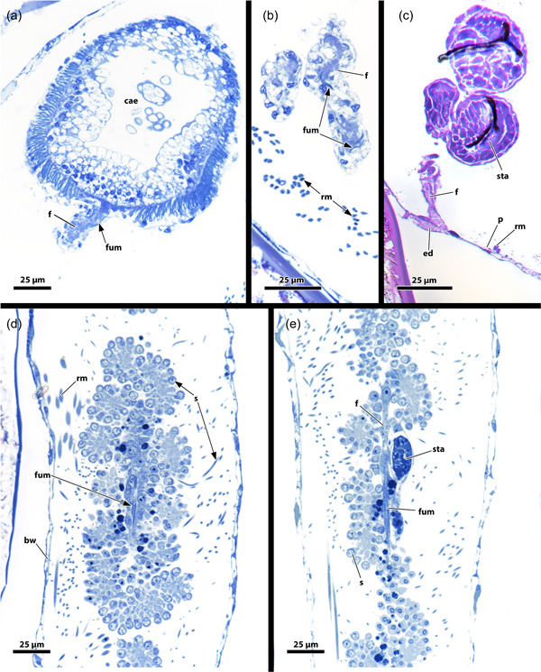 Figure 14