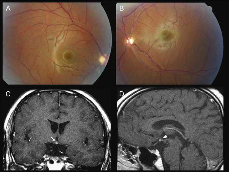 Fig. 2