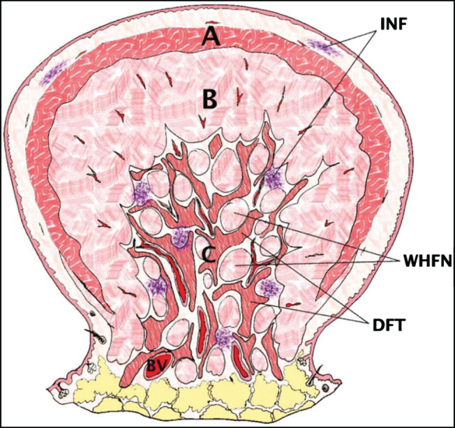 IWJ-12547-FIG-0004-c