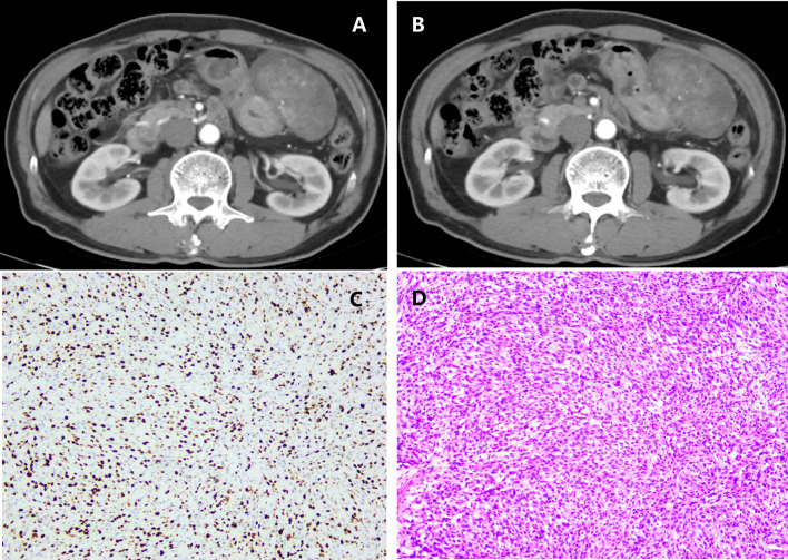 Figure 1